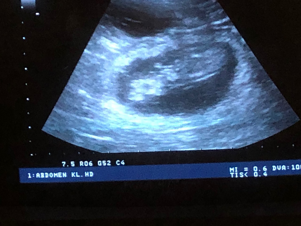 Drachtecho Drachtecho